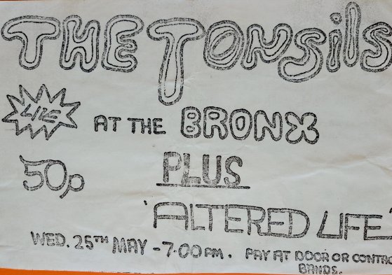 Altered Life Tonsils Bronx